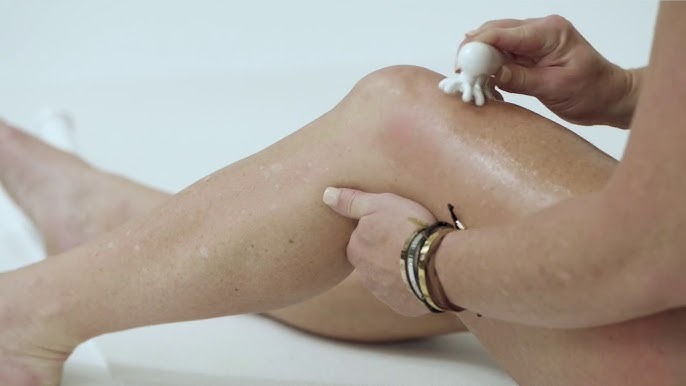 Are Tight Fascia Bands the Real Architect of Your Dimpled Skin?